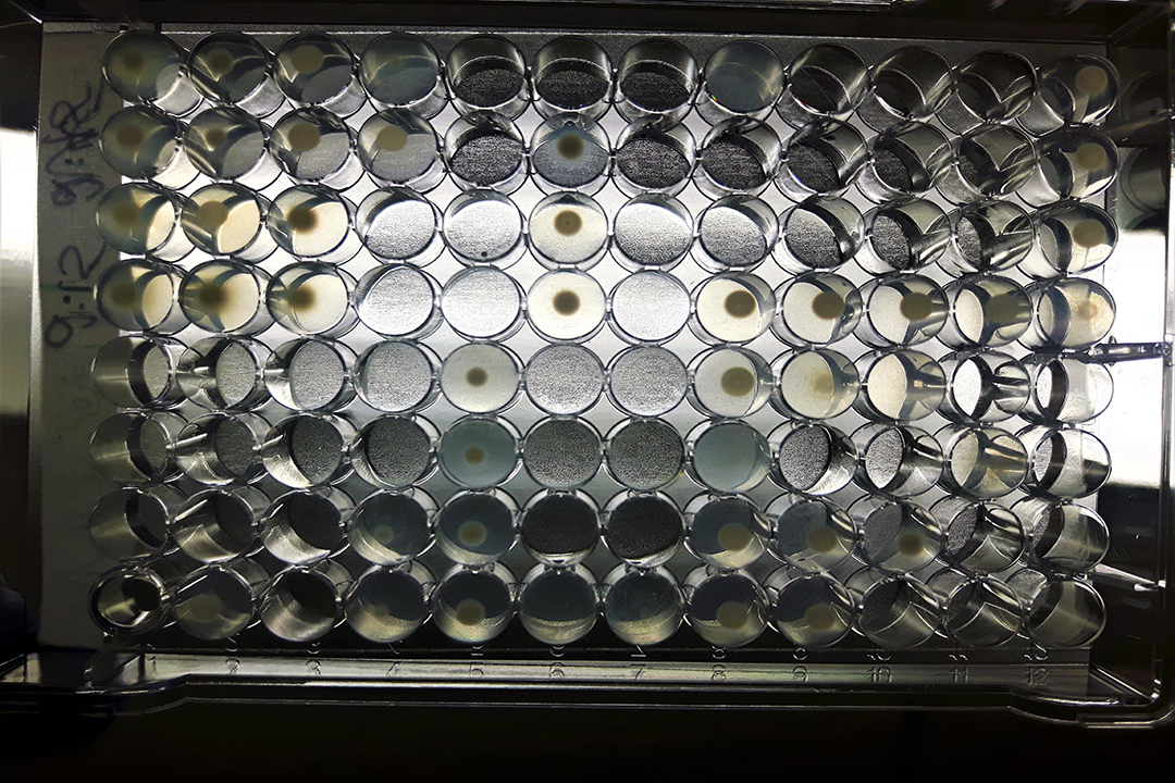 A Sensititre plate is used to assess the level of susceptibility or resistance to a particular microbial in a sample. The sample is inoculated onto wells that each contain different antimicrobials at different concentrations. If there is growth in the well, it means that that sample was resistant to that drug at that concentration. Photo by Cayla Pinheiro.